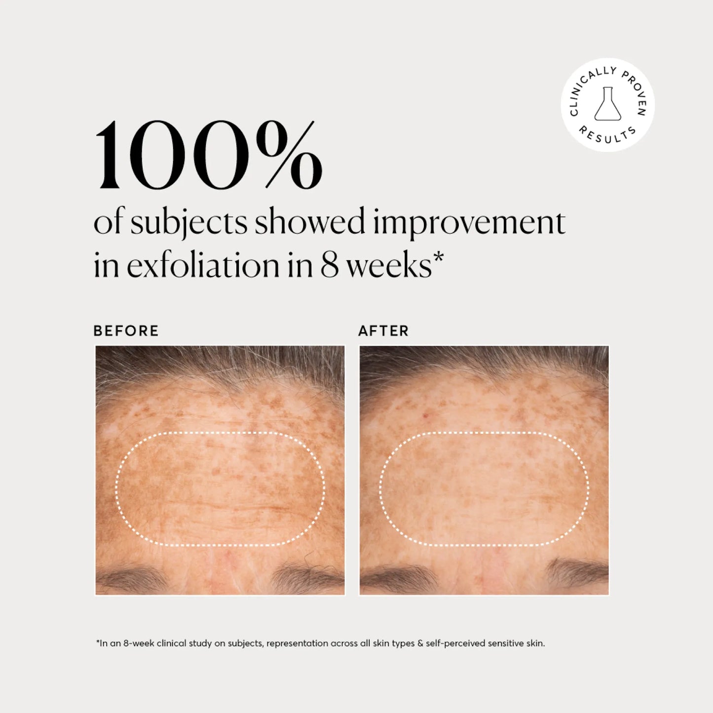 bha-liquid-exfoliant-2-g2 NATR-10027-Alt-Images-BHA-Liquid-Exfoliant-2_-03.webp