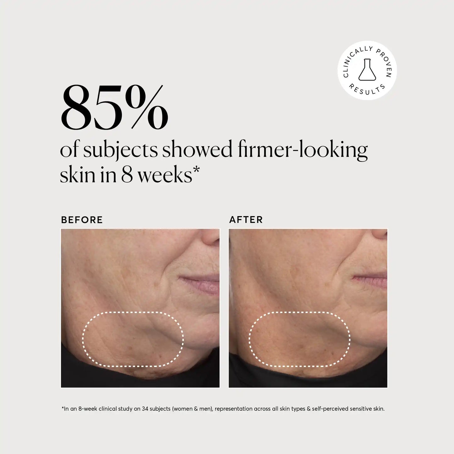 retinol-complex-serum-x7 NATR-10034-Alt-Images-Retinol-Complex-Serum-04.webp